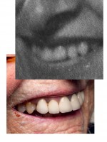 Please, pierce your bones into mine © Pippilotta Yerna